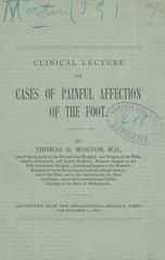 Clinical lecture on cases of painful affection of the foot