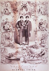"Chang" and "Eng": the world renowned united Siamese twins