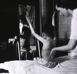 Middlesex Hospital, London, England: Pediatric surgery patient exercising