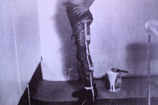 [Artificial limbs]: [Amputee and prosthesis, Philipines, 1940s(?)]