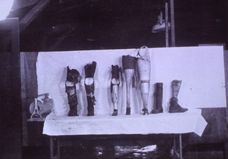 [Artificial limbs]: [Prostheses, Philipines, 1940s(?)]