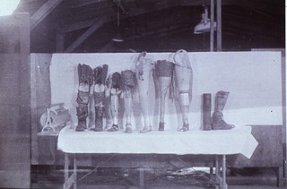 [Artificial limbs]: [Prostheses, Philipines, 1940s(?)]