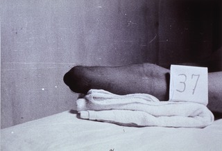 [Artificial limbs]: [Amputee, Philipines, 1940s(?)]