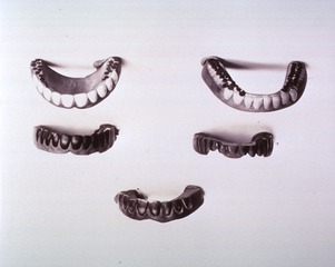 [A variety of Japanese dentures]
