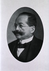 Alfred Goldscheider