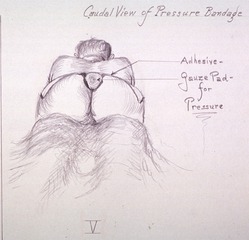 Caudal view of pressure bandage