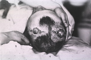 [View of open wounds on soldier's head]