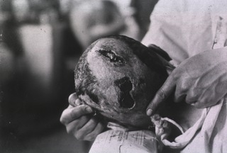 [View of open wounds on soldier's head]