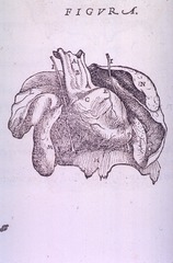 [Thoracic Section Plate]
