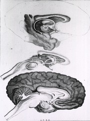 [Profile of human brain]