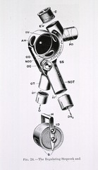 [Anesthesia: Hewitt's valve expanded]