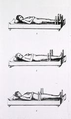 [Ancient Hindu Fracture Bed]