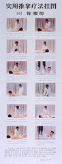 [Acupressure treatments of the back]