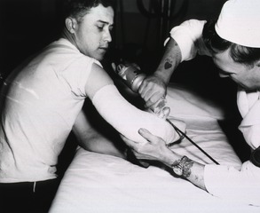 Using an electric saw to remove a cast, Camp Carson, Colorado