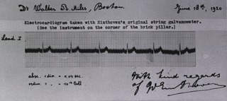 Electrocardiogram taken with Einthoven's original string galvanometer