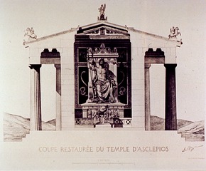 Coupe Restaurée Du Temple D'Asclepios