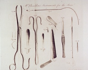 Mr. Cheseldens Instruments for the Stone