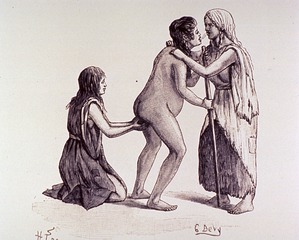 Sage-femme kiowa soufflant une poudre émétique dans la bouche de la patiente