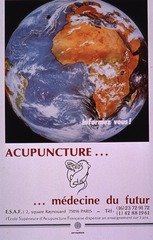 Acupuncture--: --médecine du futur