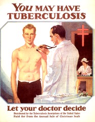You may have tuberculosis, let your doctor decide