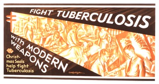 Fight tuberculosis with modern weapons