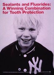Sealants and fluorides: a winning combination for tooth protection