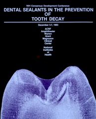 Dental sealants in the prevention of tooth decay