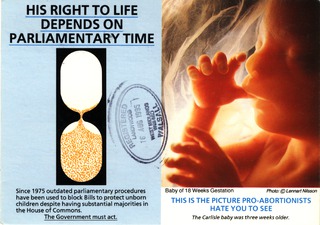 His right to life depends on parliamentary time