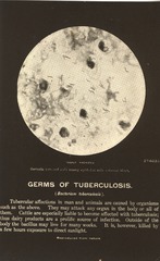 Germs of tuberculosis