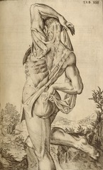 [Standing flayed cadaver, rear view]