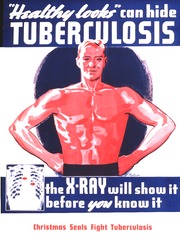 Healthy Looks Can Hide Tuberculosis