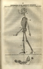 Restoration of Dr. Parkman's skeleton