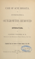 Case of acne rosacea, or hypertrophica: outgrowths removed by operation