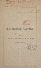 Herpes zoster frontalis