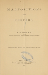 Malpositions of the ureters