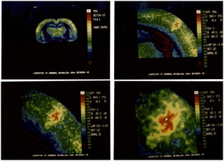 Autoradiograph of rat brain section with DG tracer, with computerized color coding (4 images)