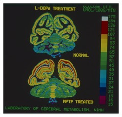 Effect of L-DOPA treatment on brain metabolism in the monkey