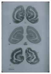 Autoradiograph of brain sections from rhesus monkeys showing effects of visual occlusion
