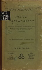 Acute pancreatitis: a consideration of pancreatic hemorrhage, hemorrhagic, suppurative, and gangrenous pancreatitis, and of disseminated fat-necrosis