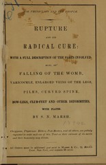 Rupture and its radical cure: with a full description of the parts involved : also, of falling of the womb, varicocele, enlarged veins of the legs, piles, curved spine, bow-legs, club-feet, and other deformities