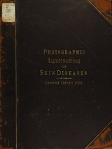 Photographic illustrations of skin diseases