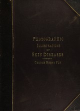 Photographic illustrations of skin diseases